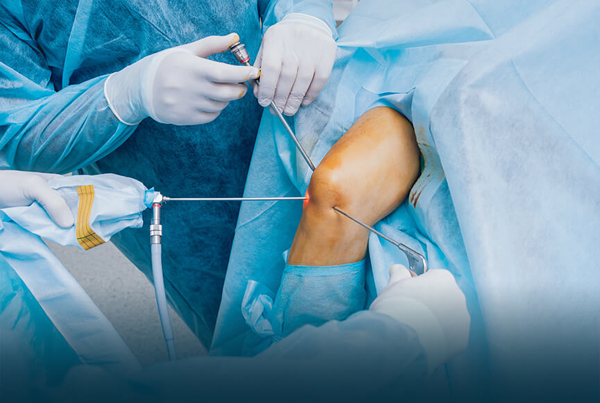 Total Knee Replacement Surgery