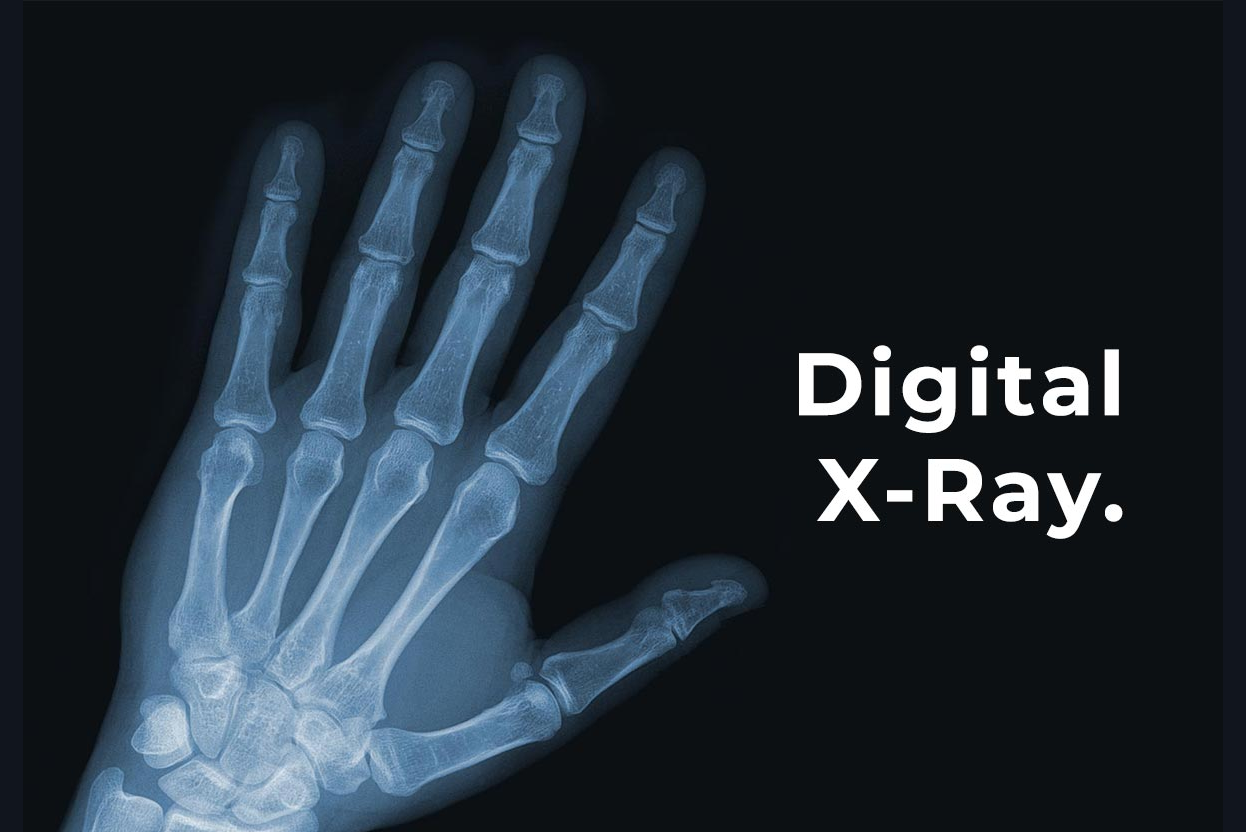 Digital X-Ray