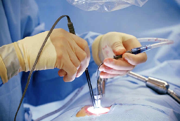 Endoscopic Discectomy