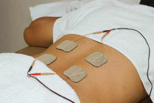 Electrical Nerve Stimulation