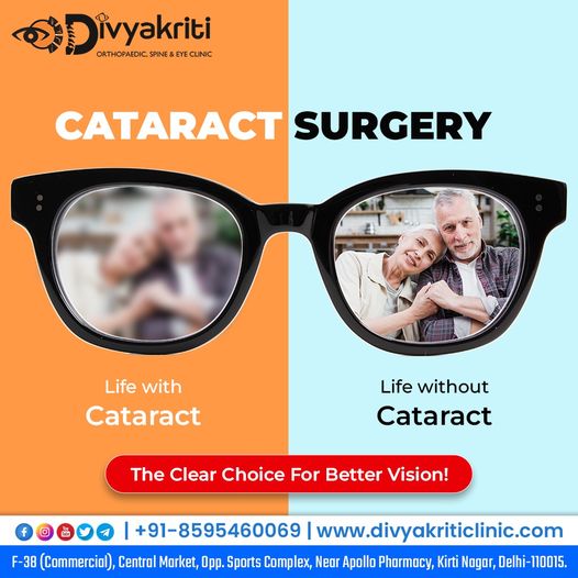 Cataract Surgery